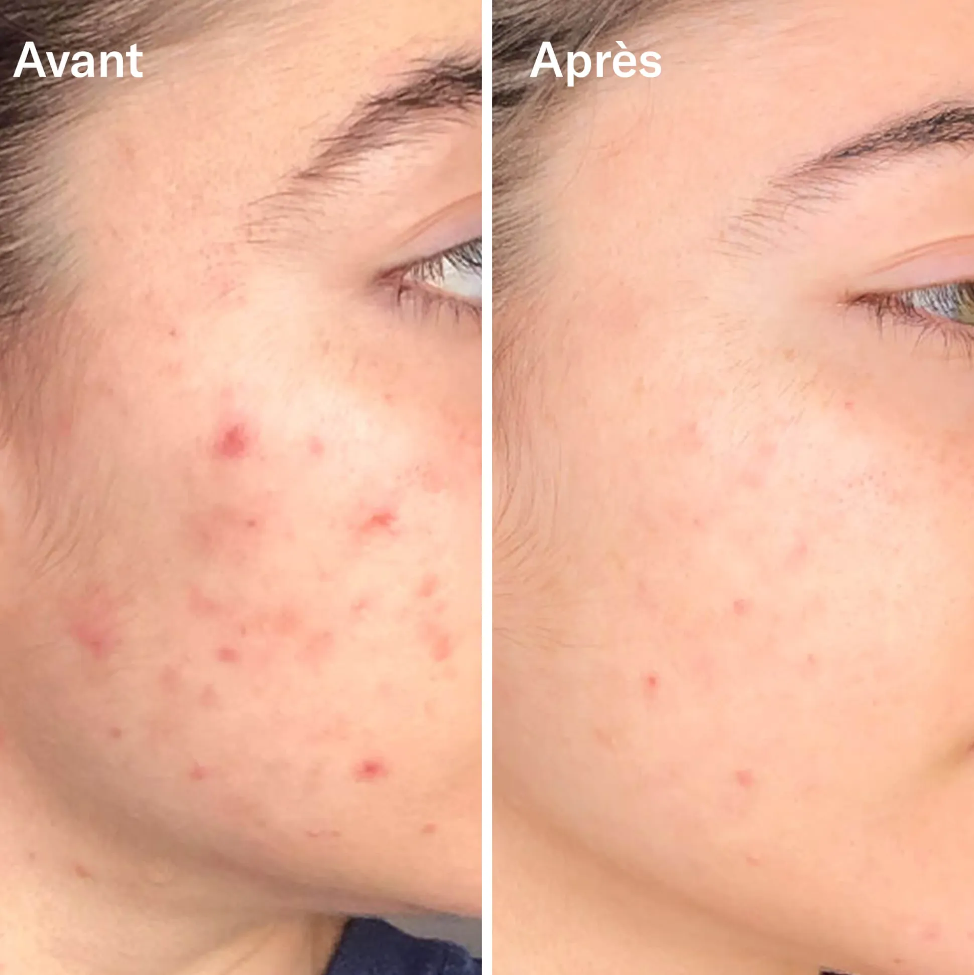 Bl+C Serum Concentré Anti-Imperfections Cumin Noir + Cajeput