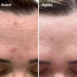 Bl+C Serum Concentré Anti-Imperfections Cumin Noir + Cajeput