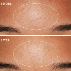 Daily Microfoliant Exfoliant Poudre