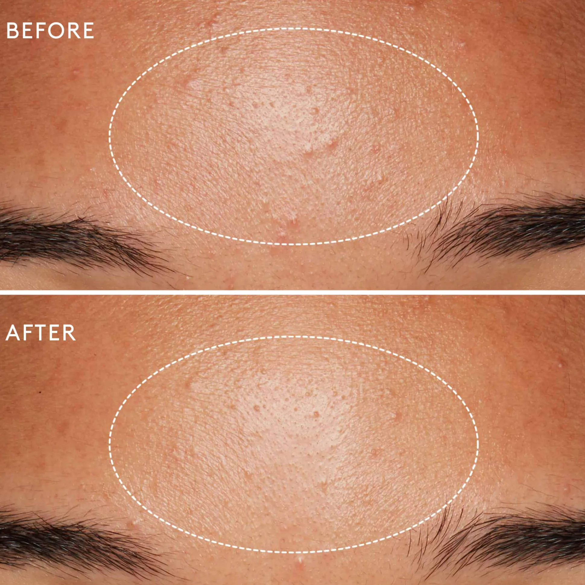 Daily Microfoliant Exfoliant Poudre